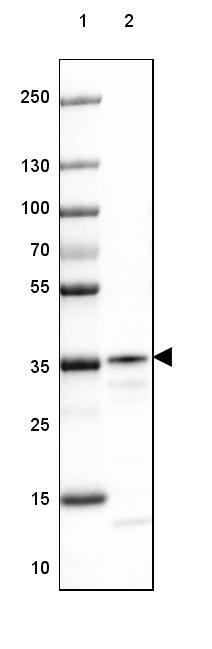 RABGGTB Antibody - BSA Free Western Blot: RABGGTB Antibody - BSA Free [NBP1-85957]