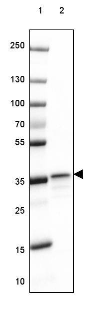 RABGGTB Antibody - BSA Free Western Blot: RABGGTB Antibody - BSA Free [NBP1-85957]