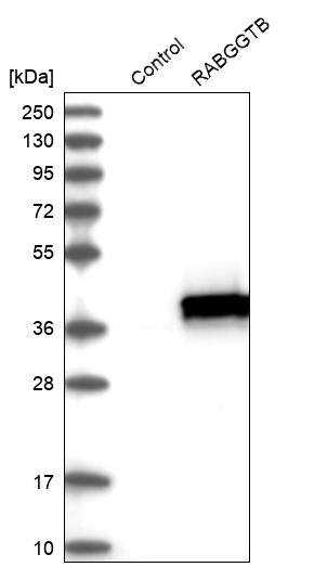 RABGGTB Antibody - BSA Free Western Blot: RABGGTB Antibody - BSA Free [NBP1-85957]