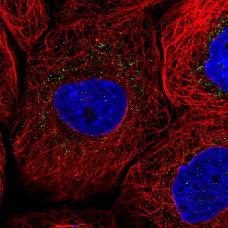 Sterol carrier protein 2 Antibody - BSA Free Immunocytochemistry/ Immunofluorescence: Sterol carrier protein 2 Antibody [NBP1-85958]