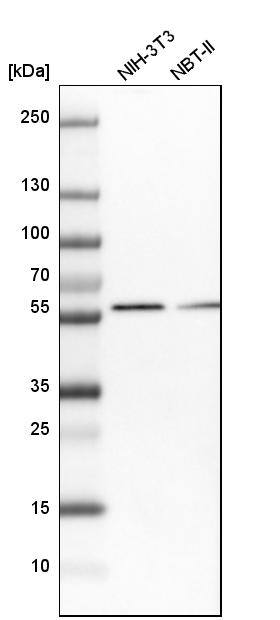 Sterol carrier protein 2 Antibody - BSA Free Western Blot: Sterol carrier protein 2 Antibody - BSA Free [NBP1-85958]