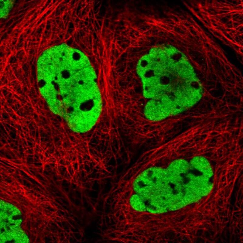 DNMT3A Antibody - BSA Free Immunocytochemistry/ Immunofluorescence: DNMT3A Antibody [NBP1-85961]
