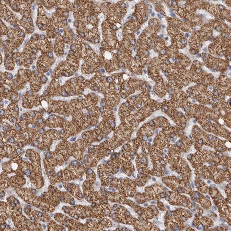 RAB18 Antibody - BSA Free Immunohistochemistry-Paraffin: RAB18 Antibody - BSA Free [NBP1-85966]