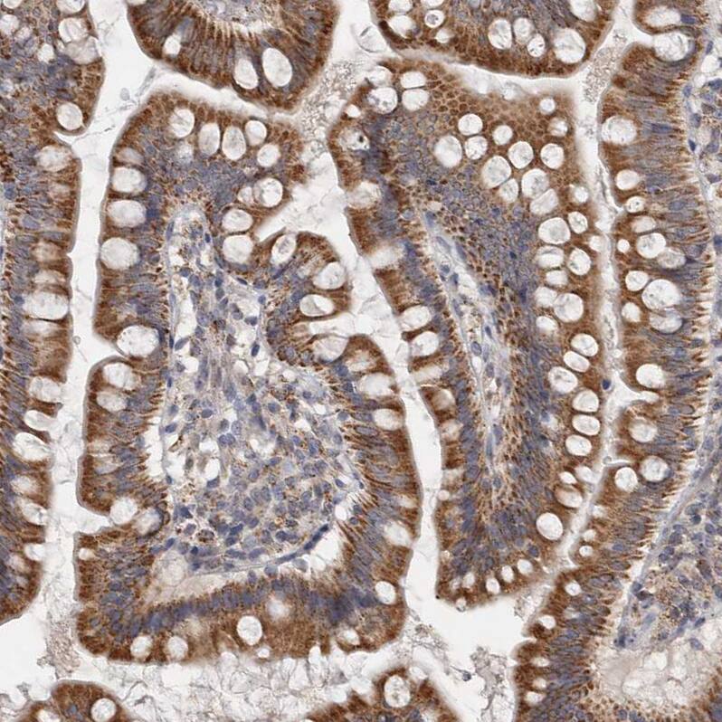 RAB18 Antibody - BSA Free Immunohistochemistry-Paraffin: RAB18 Antibody - BSA Free [NBP1-85966]