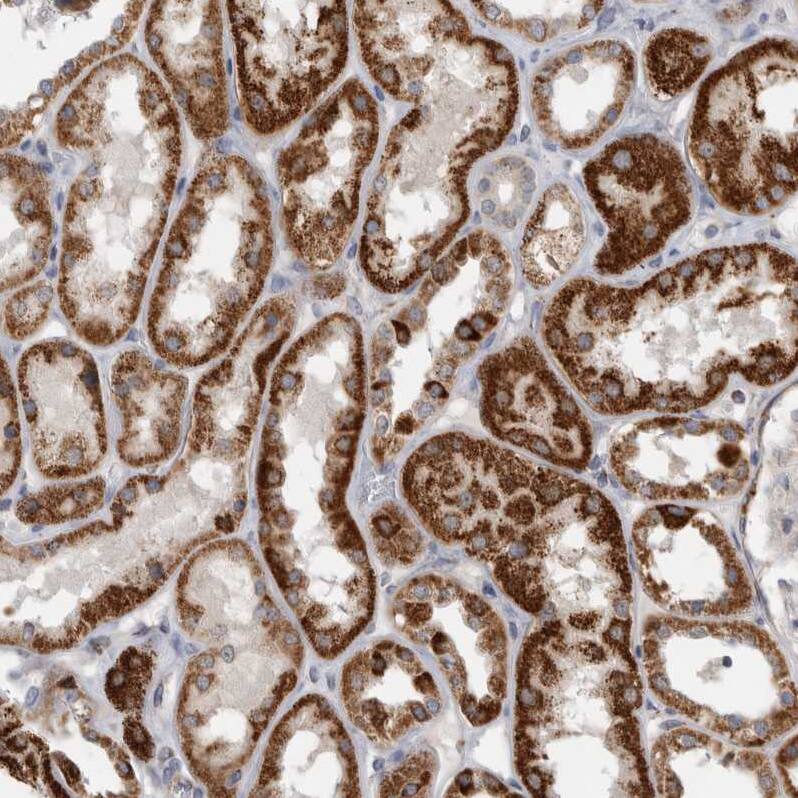 RAB18 Antibody - BSA Free Immunohistochemistry-Paraffin: RAB18 Antibody - BSA Free [NBP1-85966]