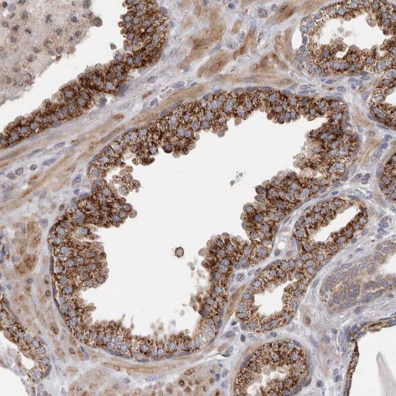 RAB18 Antibody - BSA Free Immunohistochemistry-Paraffin: RAB18 Antibody - BSA Free [NBP1-85966]