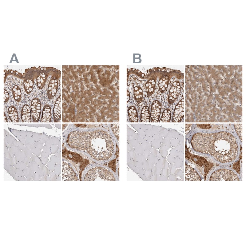 ACAT2 Antibody - BSA Free Immunohistochemistry-Paraffin: ACAT2 Antibody [NBP1-85967]