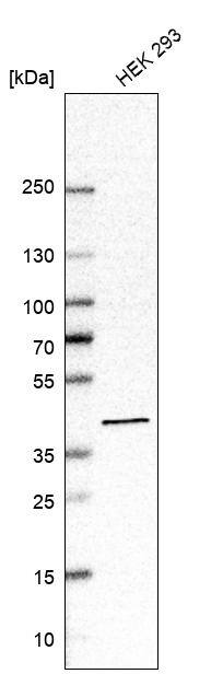 ACAT2 Antibody - BSA Free Western Blot: ACAT2 Antibody - BSA Free [NBP1-85967]