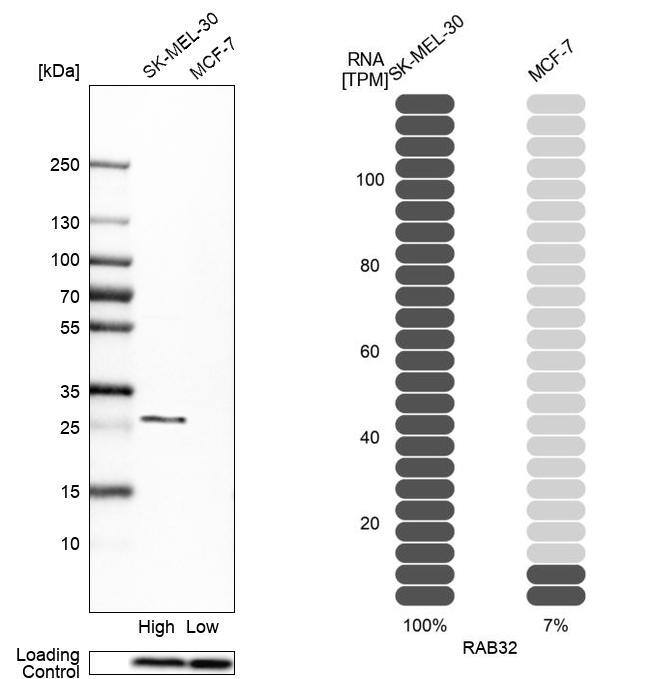 RAB32 Antibody - BSA Free Western Blot: RAB32 Antibody - BSA Free [NBP1-85968]