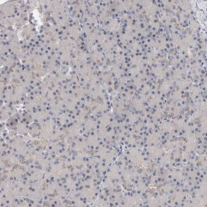 VPS28 Antibody - BSA Free Immunohistochemistry-Paraffin: VPS28 Antibody - BSA Free [NBP1-85973]
