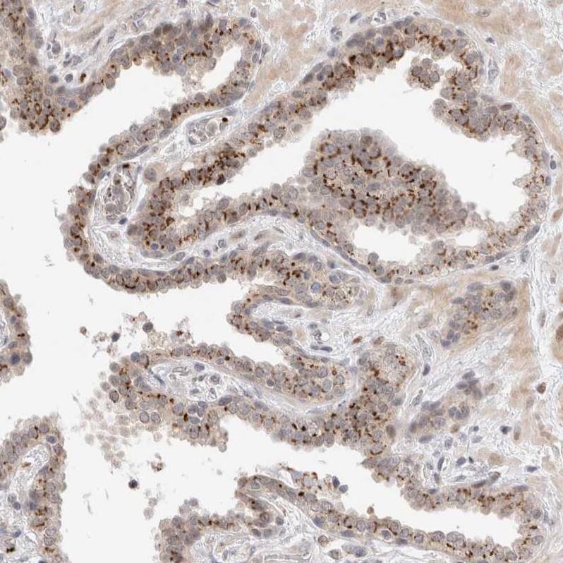 VPS28 Antibody - BSA Free Immunohistochemistry-Paraffin: VPS28 Antibody - BSA Free [NBP1-85973]