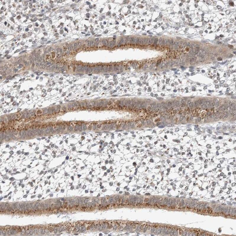 VPS28 Antibody - BSA Free Immunohistochemistry-Paraffin: VPS28 Antibody - BSA Free [NBP1-85973]