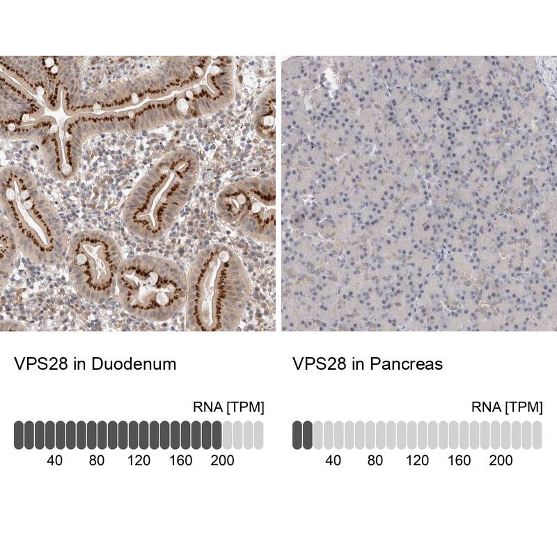 VPS28 Antibody - BSA Free Immunohistochemistry-Paraffin: VPS28 Antibody - BSA Free [NBP1-85973]