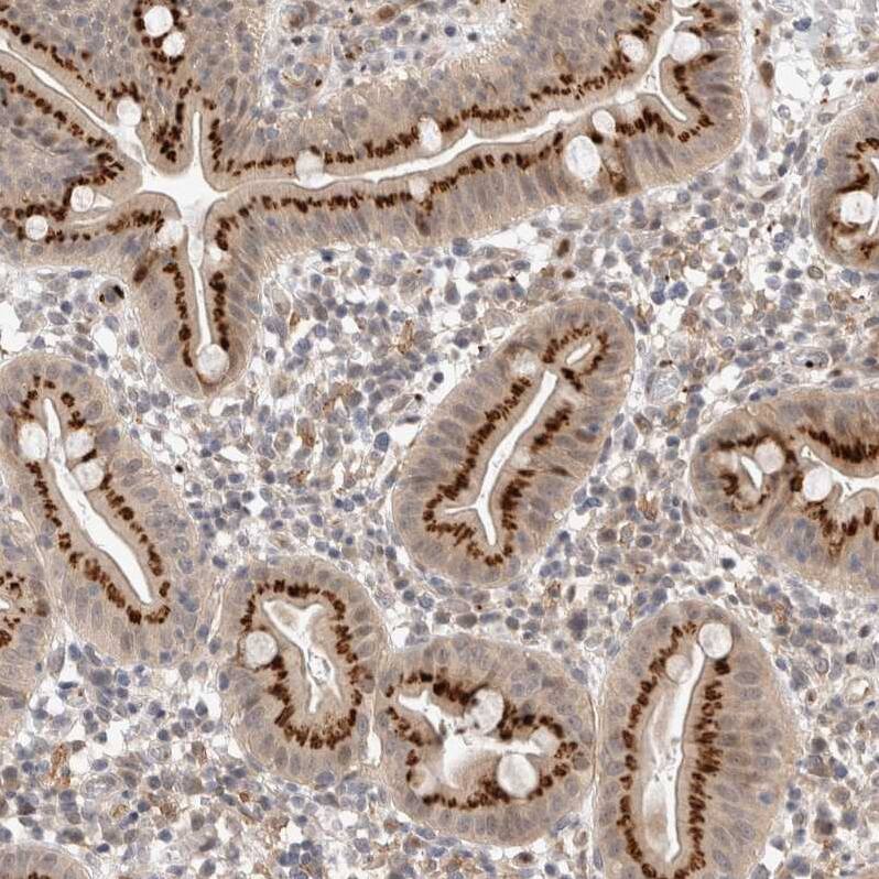 VPS28 Antibody - BSA Free Immunohistochemistry-Paraffin: VPS28 Antibody - BSA Free [NBP1-85973]