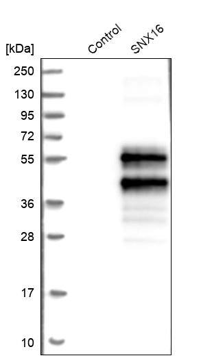 SNX16 Antibody - BSA Free Western Blot: SNX16 Antibody - BSA Free [NBP1-85974]