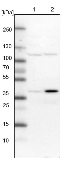 SNX16 Antibody - BSA Free Western Blot: SNX16 Antibody - BSA Free [NBP1-85975]