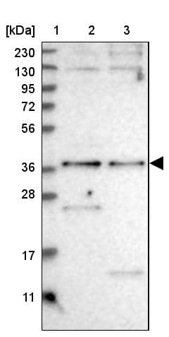 SNX16 Antibody - BSA Free Western Blot: SNX16 Antibody - BSA Free [NBP1-85975]