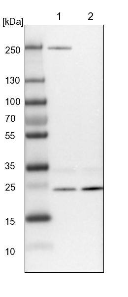 VPS28 Antibody - BSA Free Western Blot: VPS28 Antibody - BSA Free [NBP1-85976]