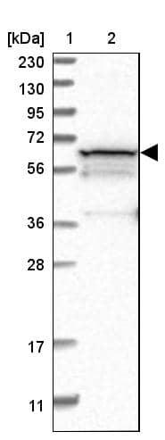 PGM1 Antibody - BSA Free Western Blot: PGM1 Antibody - BSA Free [NBP1-85977]