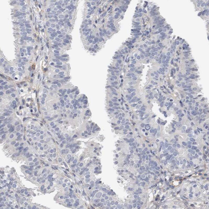 PGM1 Antibody - BSA Free Immunohistochemistry-Paraffin: PGM1 Antibody - BSA Free [NBP1-85982]