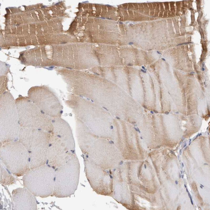 PGM1 Antibody - BSA Free Immunohistochemistry-Paraffin: PGM1 Antibody - BSA Free [NBP1-85982]