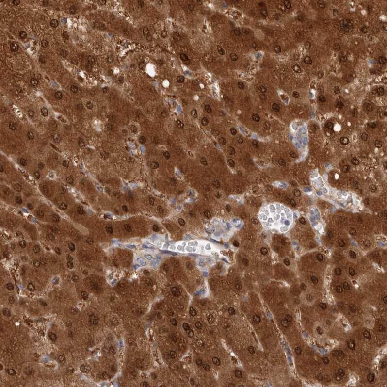 PGM1 Antibody - BSA Free Immunohistochemistry-Paraffin: PGM1 Antibody - BSA Free [NBP1-85982]
