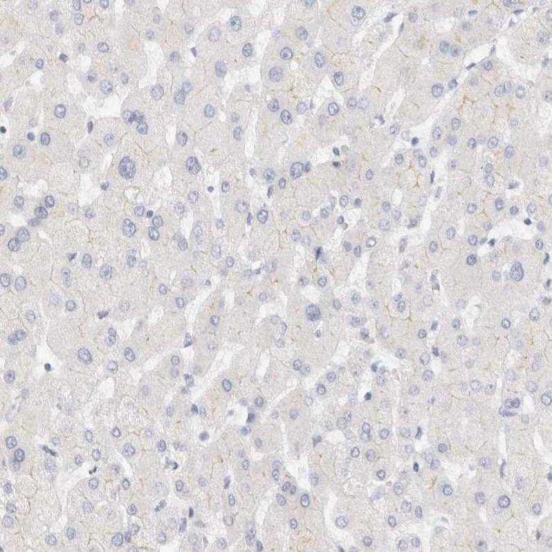 LMCD1 Antibody - BSA Free Immunohistochemistry-Paraffin: LMCD1 Antibody - BSA Free [NBP1-85986]