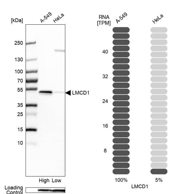 LMCD1 Antibody - BSA Free Western Blot: LMCD1 Antibody - BSA Free [NBP1-85986]