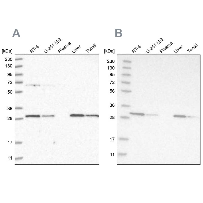 PROSC Antibody - BSA Free Western Blot: PROSC Antibody - BSA Free [NBP1-85989]