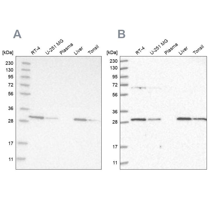 PROSC Antibody - BSA Free Western Blot: PROSC Antibody - BSA Free [NBP1-85991]