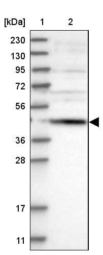 SCRN2 Antibody - BSA Free Western Blot: SCRN2 Antibody - BSA Free [NBP1-85994]
