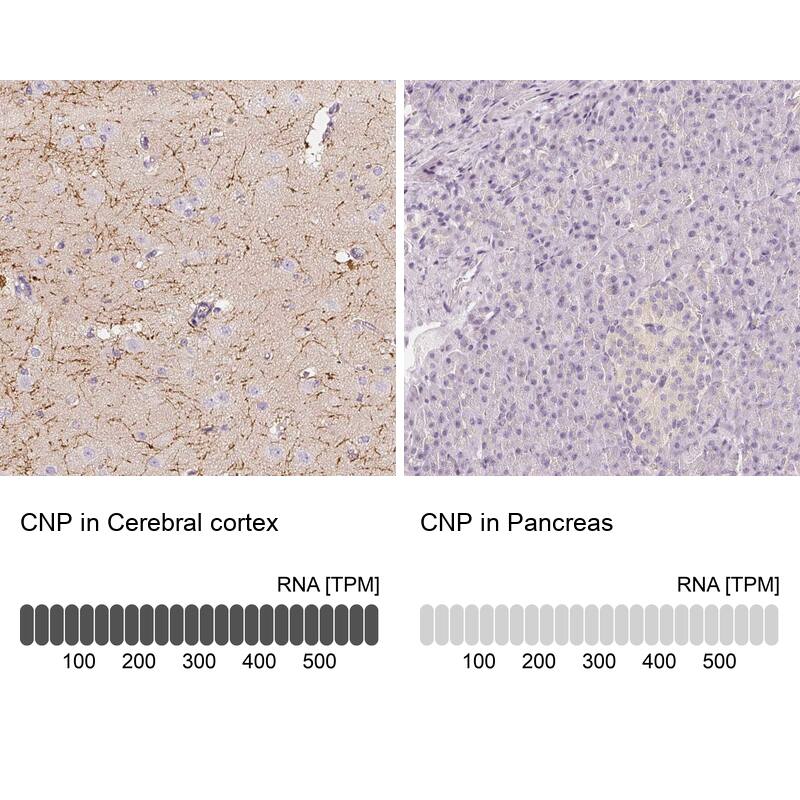 CNPase Antibody - BSA Free Immunohistochemistry-Paraffin: CNPase Antibody - BSA Free [NBP1-85995]