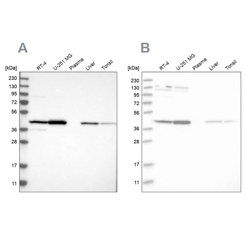CNPase Antibody - BSA Free Western Blot: CNPase Antibody - BSA Free [NBP1-85997]