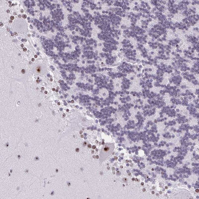 ZNF800 Antibody - BSA Free Immunohistochemistry-Paraffin: ZNF800 Antibody - BSA Free [NBP1-86001]