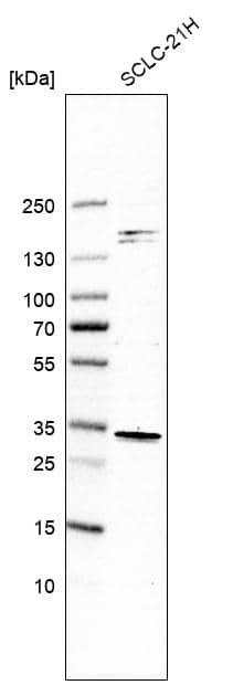 Sirtuin 5/SIRT5 Antibody - BSA Free Western Blot: Sirtuin 5/SIRT5 Antibody - BSA Free [NBP1-86004]