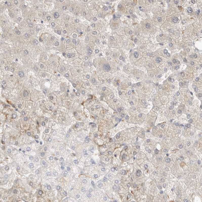 TOM1L2 Antibody - BSA Free Immunohistochemistry-Paraffin: TOM1L2 Antibody - BSA Free [NBP1-86006]