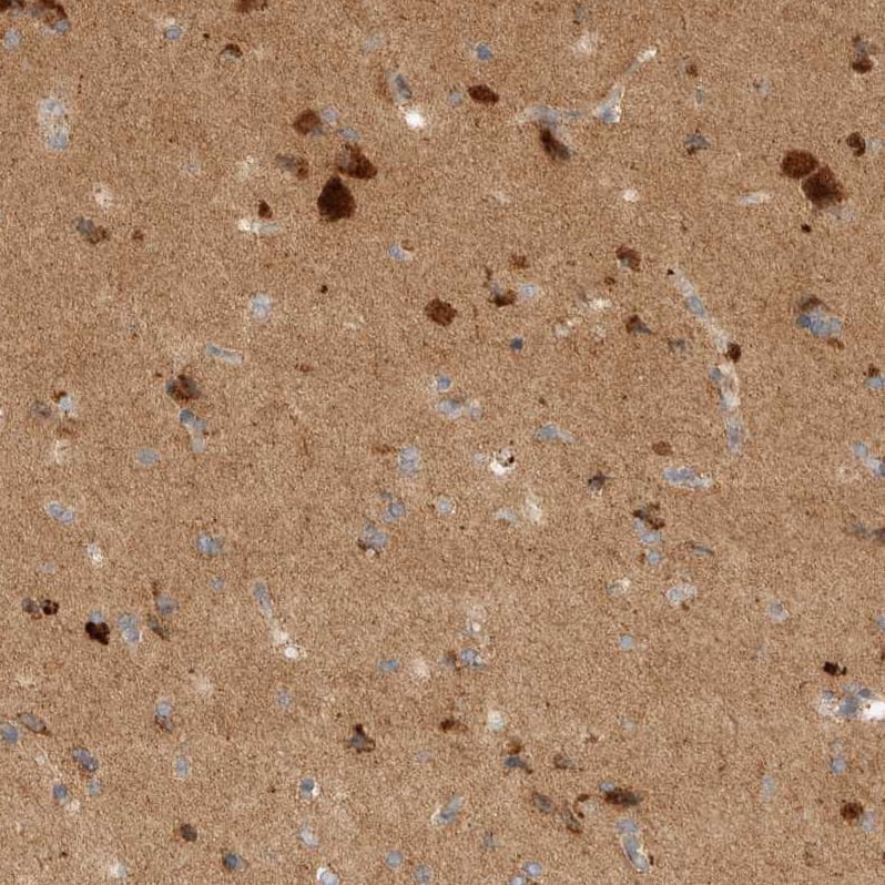 TOM1L2 Antibody - BSA Free Immunohistochemistry-Paraffin: TOM1L2 Antibody - BSA Free [NBP1-86006]