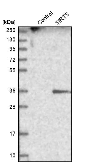Sirtuin 5/SIRT5 Antibody - BSA Free Western Blot: Sirtuin 5/SIRT5 Antibody - BSA Free [NBP1-86013]