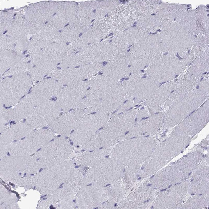 ACTL7A Antibody - BSA Free Immunohistochemistry-Paraffin: ACTL7A Antibody - BSA Free [NBP1-86014]