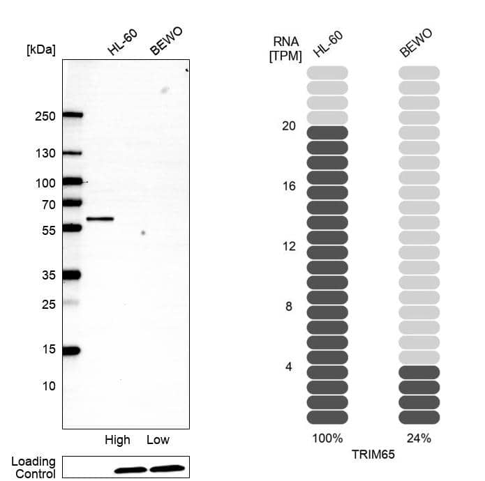 TRIM65 Antibody - BSA Free Western Blot: TRIM65 Antibody - BSA Free [NBP1-86017]