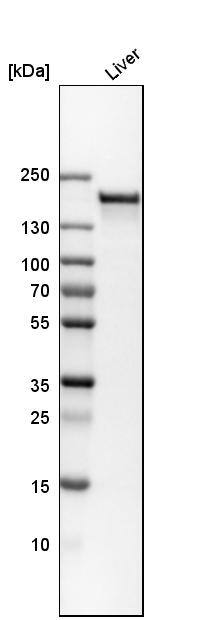 CPS1 Antibody - BSA Free Western Blot: CPS1 Antibody - BSA Free [NBP1-86019]