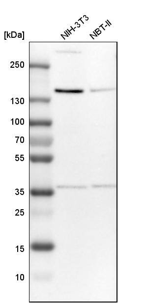 Tripeptidyl peptidase II Antibody - BSA Free Western Blot: Tripeptidyl peptidase II Antibody - BSA Free [NBP1-86022]