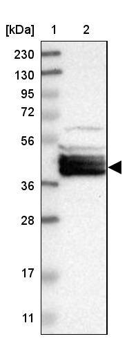 BCL2L12 Antibody - BSA Free Western Blot: BCL2L12 Antibody - BSA Free [NBP1-86025]