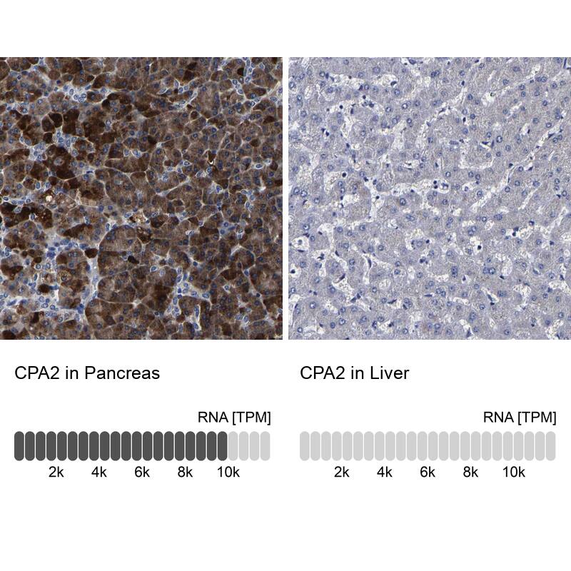 Carboxypeptidase A2/CPA2 Antibody - BSA Free Immunohistochemistry-Paraffin: Carboxypeptidase A2/CPA2 Antibody [NBP1-86028]