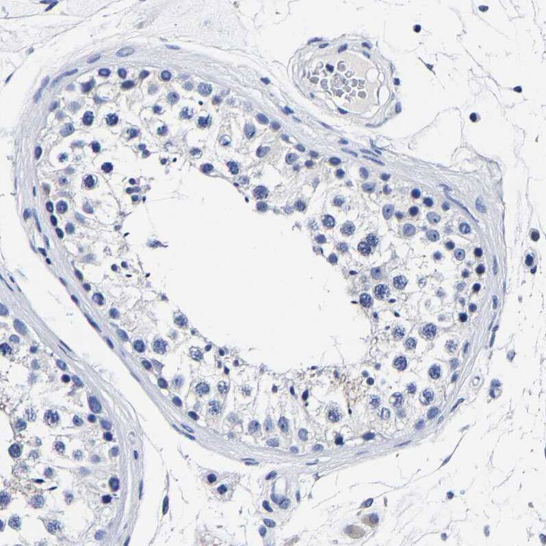 Carboxypeptidase A2/CPA2 Antibody - BSA Free Immunohistochemistry-Paraffin: Carboxypeptidase A2/CPA2 Antibody [NBP1-86028]