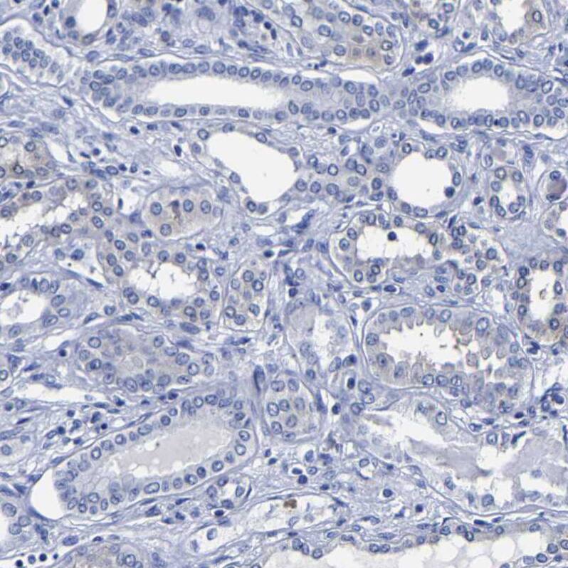 Carboxypeptidase A2/CPA2 Antibody - BSA Free Immunohistochemistry-Paraffin: Carboxypeptidase A2/CPA2 Antibody [NBP1-86028]