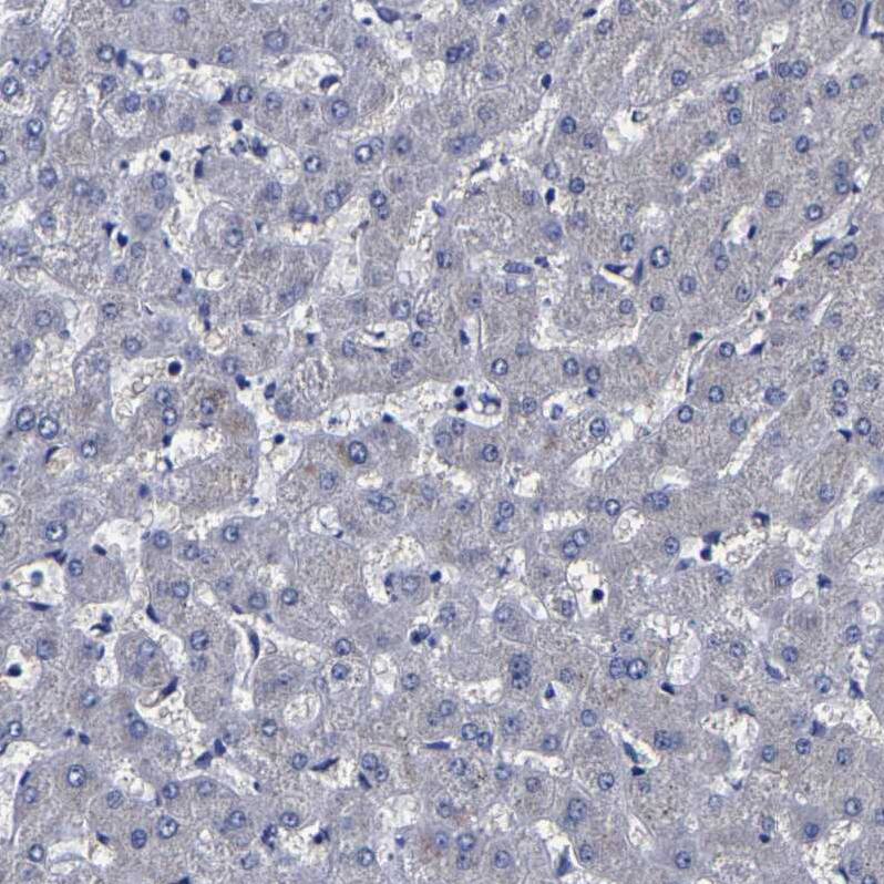 Carboxypeptidase A2/CPA2 Antibody - BSA Free Immunohistochemistry-Paraffin: Carboxypeptidase A2/CPA2 Antibody [NBP1-86028]