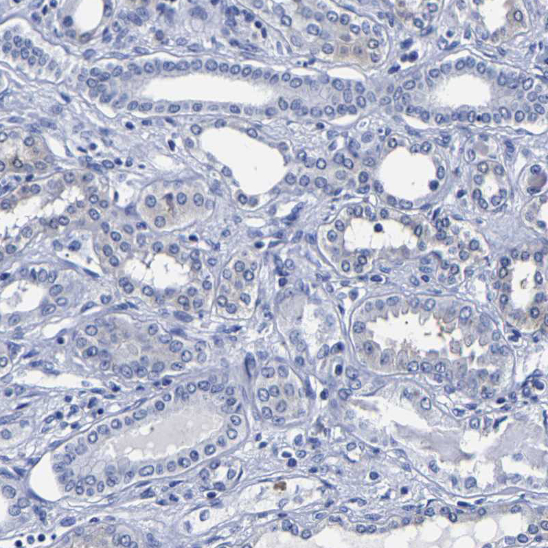 Carboxypeptidase A2/CPA2 Antibody - BSA Free Immunohistochemistry-Paraffin: Carboxypeptidase A2/CPA2 Antibody - BSA Free [NBP1-86028]