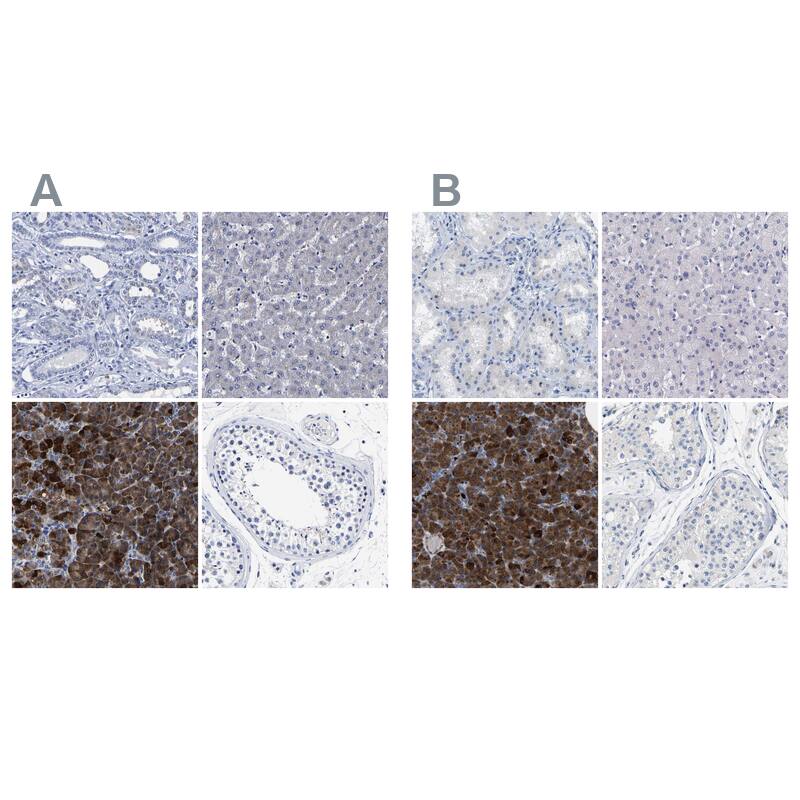 Carboxypeptidase A2/CPA2 Antibody - BSA Free Immunohistochemistry-Paraffin: Carboxypeptidase A2/CPA2 Antibody - BSA Free [NBP1-86028]