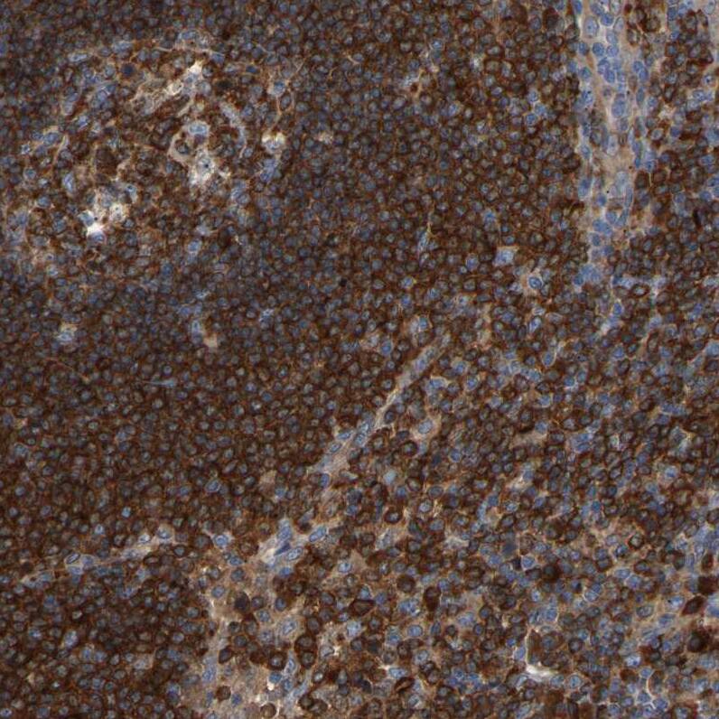 PLC-gamma 2 Antibody - BSA Free Immunohistochemistry-Paraffin: PLC-gamma 2 Antibody - BSA Free [NBP1-86030]